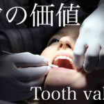 1本の歯の価値は最低でも○○万円！！歯のメンテナンスは大事だよって話。